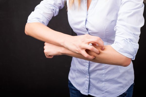 People with allergic reactions should take precautionary measures when taking probiotics